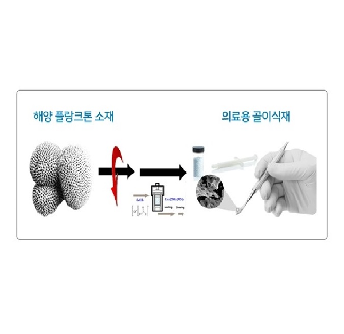 셀코, 해양 플랑크톤 기반 의료용 골이식재 상용화 나서 대표 이미지